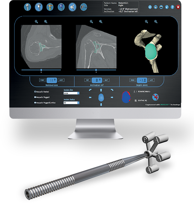Wright Medical on Twitter "33rd Annual San Diego Shoulder Course