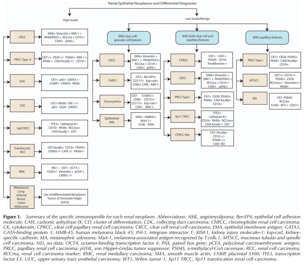 ArchivesPath's tweet photo. Algorithm/immunoprofile summary for EACH renal neoplasm https://t.co/0zV67Z6KgH https://t.co/pPGt7lIT4f