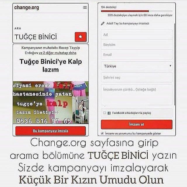 onurbbtrfan's tweet photo. Tuğçe'ye kan ve kalp lazım! #tuğçeyekalplazım #kızılay #kan #arh+ #organbağışı #organbağışıhayatkurtarır https://t.co/MDM109uzuA