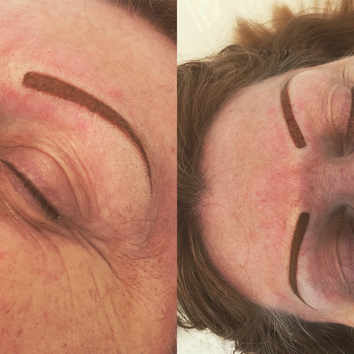 bella_whites's tweet photo. Semi permanent block eyebrows 💉 https://t.co/aW4zmhjuCl