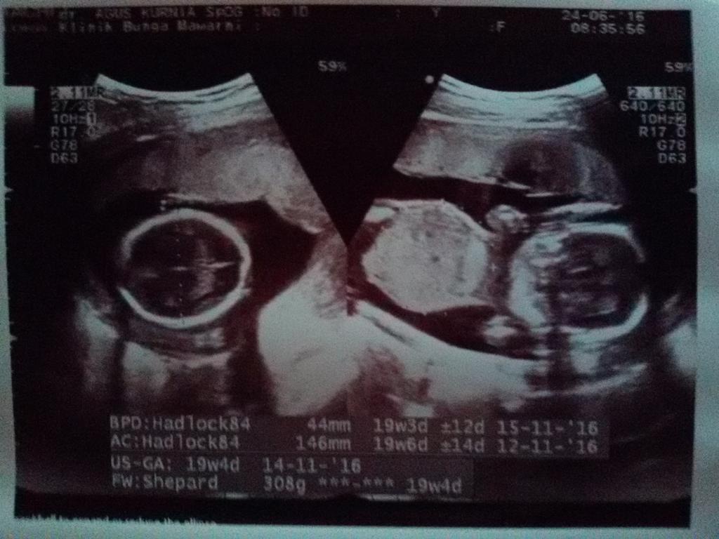 erniajani's tweet photo. Alhamdulilahirobilalamin sehat terus cantik 😊😊😊😇 https://t.co/DAibfL7hC5