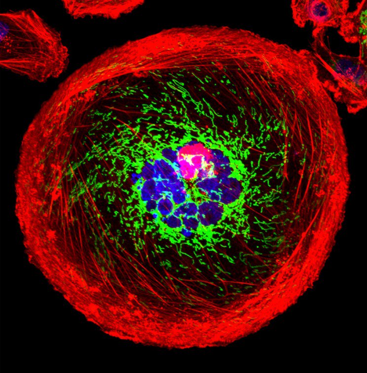 theNCI's tweet image. What's cancer look like up close? Here are new images from #NCIcancercenters: 1.usa.gov/1W3gdSq #cancercloseup