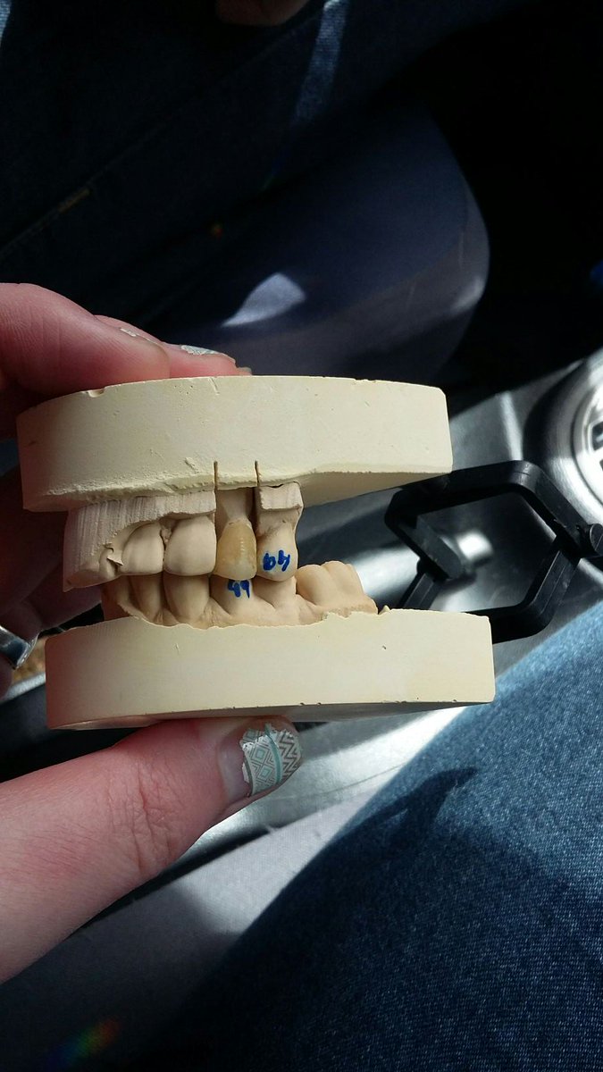 RaisedbyDogs's tweet photo. I found some teeth in the grass at the rest stop. #scavenger https://t.co/RdYhnJtwHO