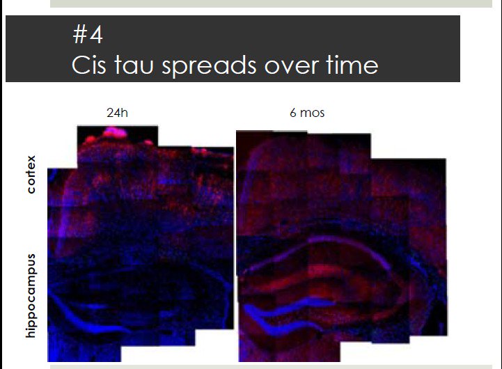 griz1's tweet photo. #DrRebekahMannix #cisTau seen w mouse #mTBI; repeat mTBI more cisTau, assoc w #AxonalInjury & it spreads. #AANSCC https://t.co/sjsuF8eZNL