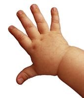 Curtis Wilson on X: @BabyHand2 Little Hand. Baby hands have inverted  chubby knuckles, whereas the aforementioned hand is matured.   / X