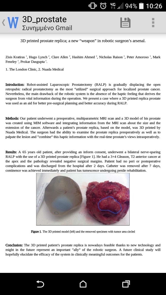 3D printed model #prostatectomy at #ESUT16.
Special thanks to prof. Dasgupta <a href="/prokarurol/">Prof. Prokar Dasgupta OBE</a>