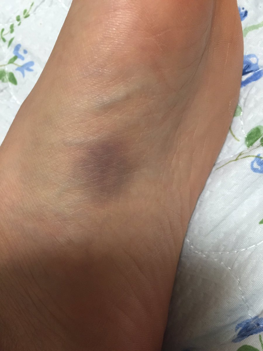 三咲はる 5 31ﾊﾞﾝﾄﾞﾜﾝﾏﾝlive Aube渋谷来て欲しい 消化器系もだけど 栄養不足なのかなぁ