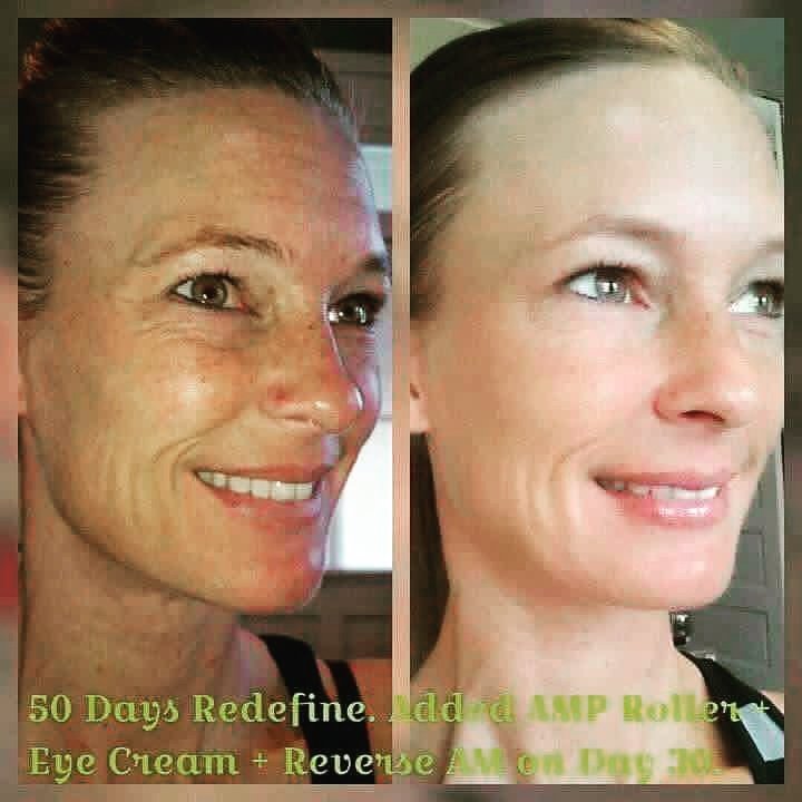 kylie_randf's tweet photo. #rodanandfields #ReverseTheSignsOfAging #GlowingSkin #NoMoreSunDamage #Boom #healthyskin #messageme https://t.co/3qOyh0yClH