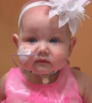 CBCOttawa's tweet image. ICYMI | Smiths Falls boy performs song for 'little baby Everley' at CHEO cbc.ca/1.3671977 #ottnews