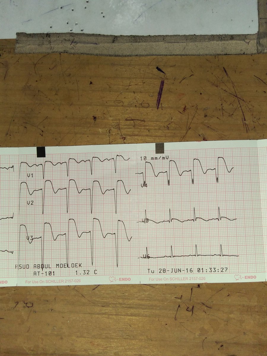 Jam 3 malam, lanjut trombolitik