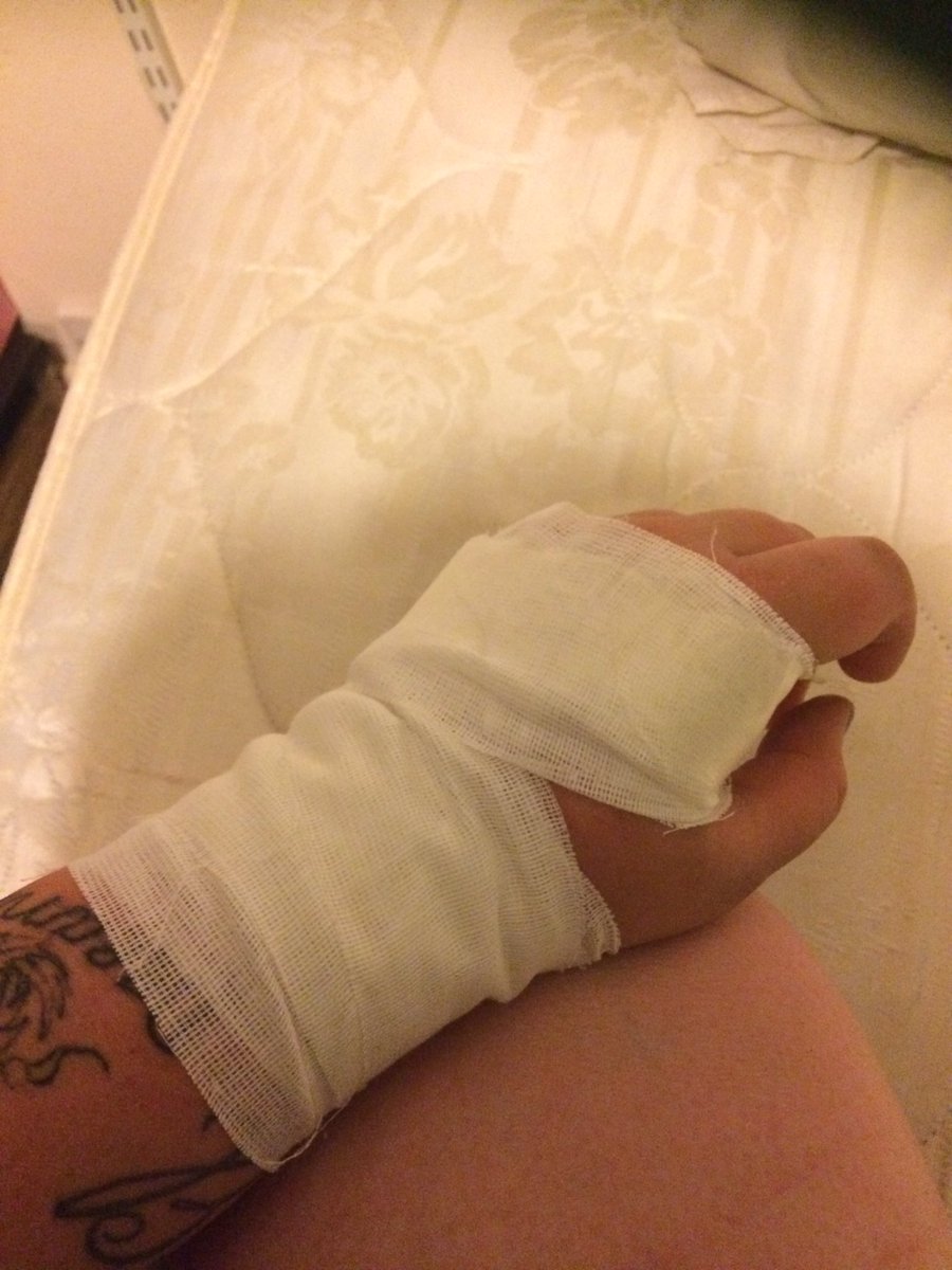 heyitsmegss's tweet photo. My attempt at DIY First Aid, fair to say I am not qualified! 🙈 https://t.co/t2lieRtpfT