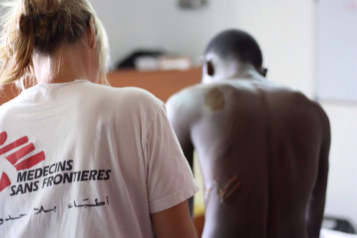 MSF_Sea's tweet photo. Many people currently onboard #Aquarius assaulted in Libya. #MSF doctor treats old wounds + recent violent injuries https://t.co/T36z4fx4cf