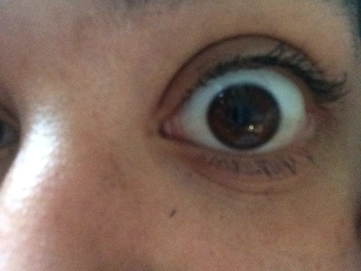 FelicitiGarner's tweet image. #swimforsight @SwimForSight @jackgilinsky @JackJ 👁