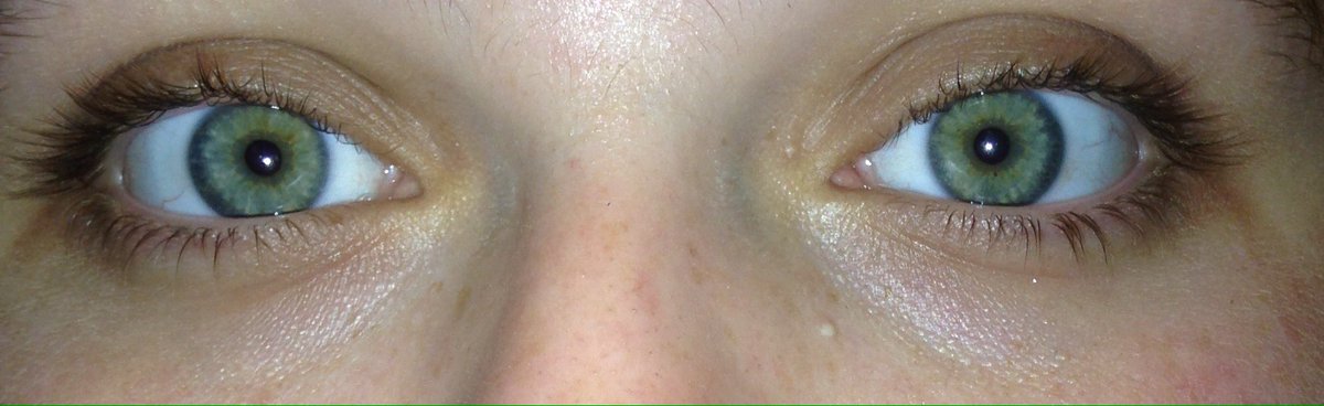 infinitejohnson's tweet image. #swimforsight 👀