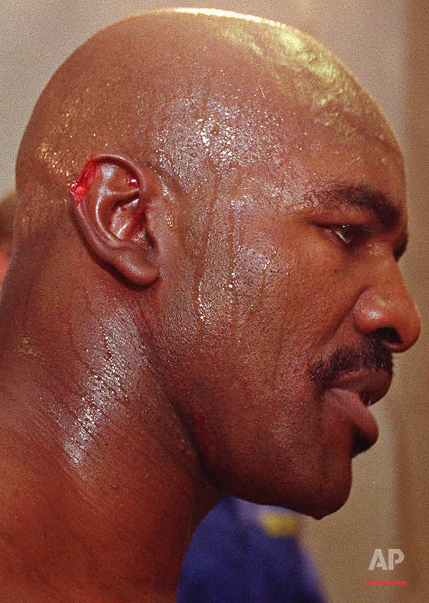 Image result for boxer mike tyson was disqualified for biting evander holyfield's ear.