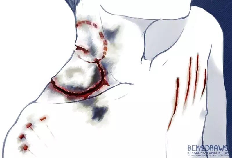 aesthetic_hell's tweet photo. the scars are still there // credit to beksboys.tumblr https://t.co/uoxIxNlRDy