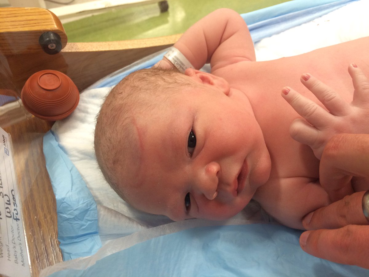 marshallwilmhof's tweet photo. Welcome Brooks Patrick Wilmhoff to the Bluegrass! He weighs in at 10"4'. He and Jenna are doing great! https://t.co/doECvhY2uI