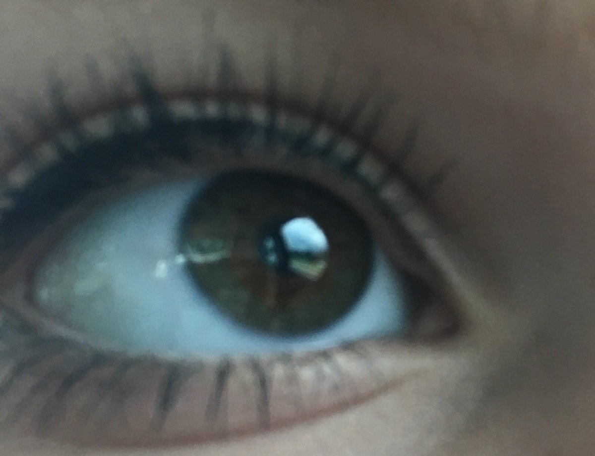 shullbae's tweet image. #swimforsight @swimforsight @JackJ @jackgilinsky