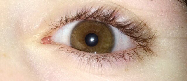 cassvalade's tweet image. #swimforsight @SwimForSight @JackJ @jackgilinsky