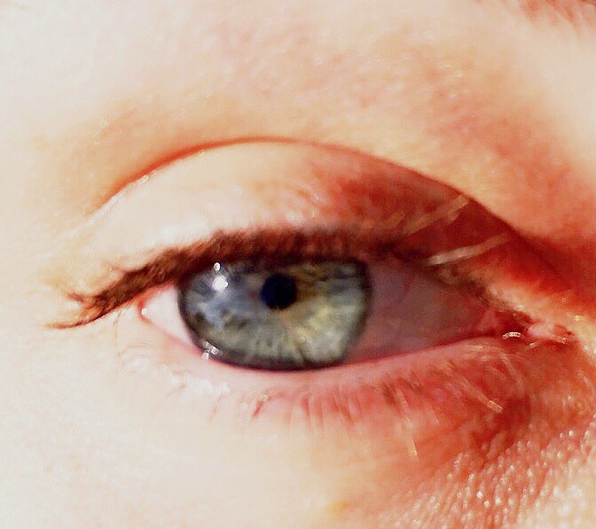 JVCKJ's tweet image. hell ya! $25 cures 1 blind person with @SwimForSight. I challenge @iamKennyHolland ! #swimforsight