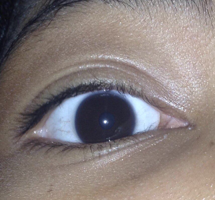 avocadoespinosa's tweet image. Let&apos;s help cure the blind ❤️#swimforsight