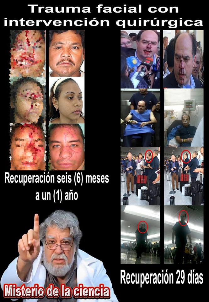 TECNOLOCOFUL's tweet photo. Que alguien me explique cómo es posible que Julio Borges se haya recuperado tan rápido
#JulioBorgesEsPuraPaja https://t.co/C6r6JU2HGN