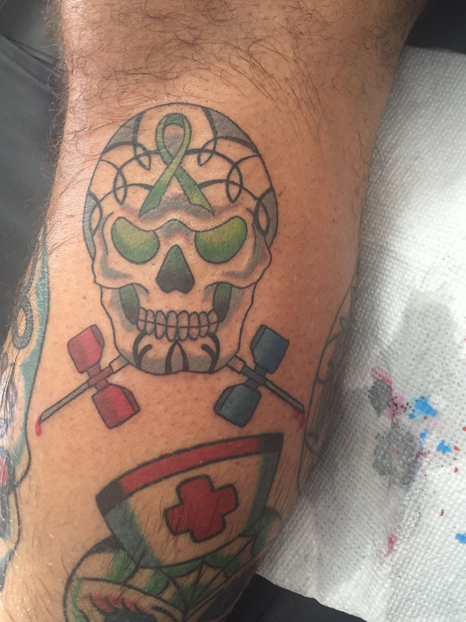Infected Tattoo Stages: Signs, Treatment, What to Expect