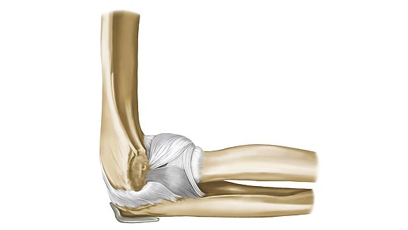 emedicalbroker's tweet photo. The #elbow joint is formed by three bones: the humerus (upper arm), the radius and the ulna. #knowmore https://t.co/QYrKxuxM4D