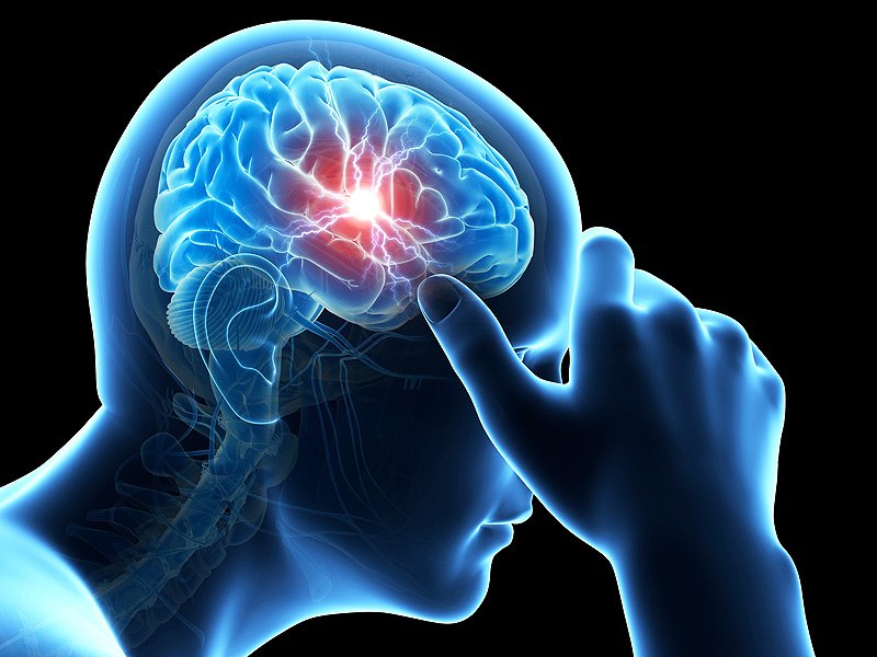 TouchSurgery's tweet photo. Genomic data finds that #Migraines may be a vascular disorder https://t.co/eXeBqndcXd #MHAMBC https://t.co/n37J0YqiqF