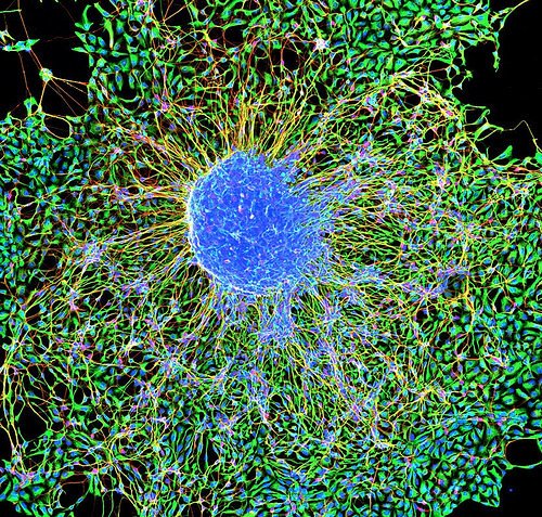 New evidence suggests the brain can repair itself - with help ow.ly/egou301LxYe