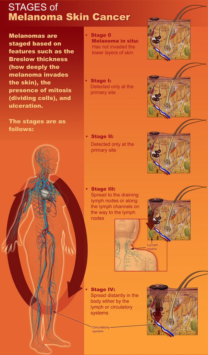 MountSinaiNYC's tweet photo. Learn about the #Melanoma #SkinCancer &amp; get your FREE screening at #AspenIdeas! https://t.co/opYVqxAqQG https://t.co/LPI1NU40He