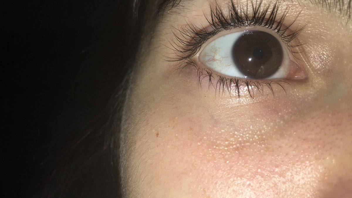 camelanc's tweet image. #swimforsight