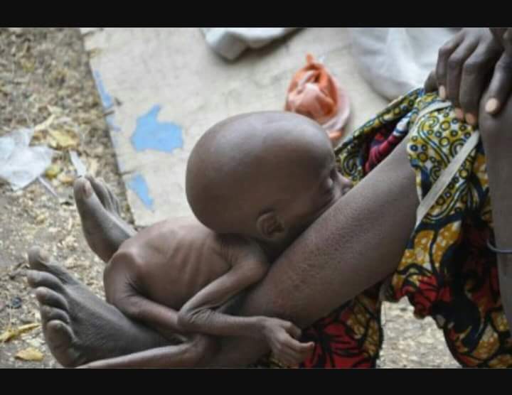 ADCVanguard_'s tweet photo. Buhari is simply a wicked President who cares less that children are dying in the North east due to malnutrition. https://t.co/XTvXfzsG1p