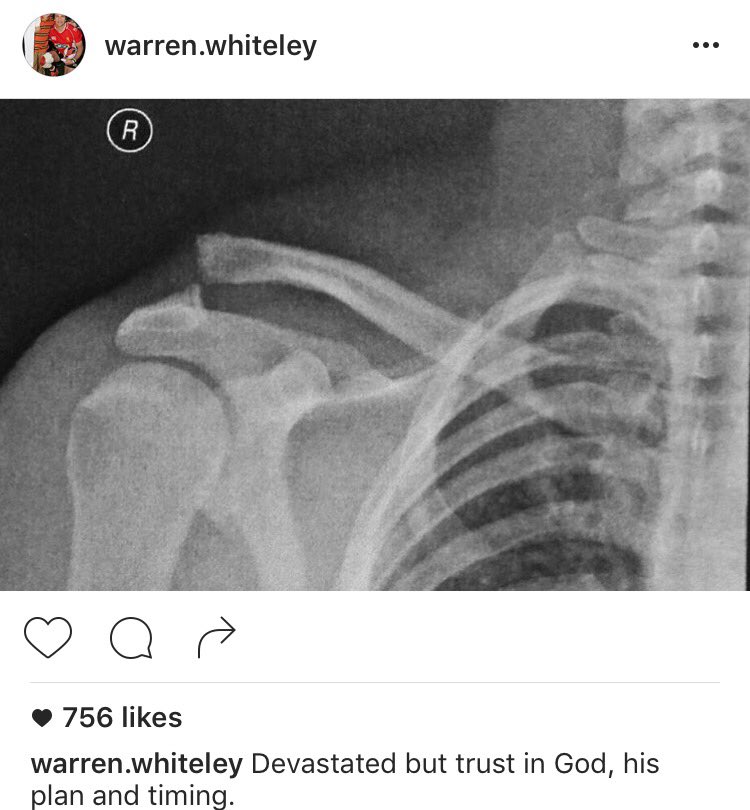 leonlnaude's tweet photo. What @WarrenWhiteley played through on Saturday! That is why he is the boss!  https://t.co/FQvIJ44DOm