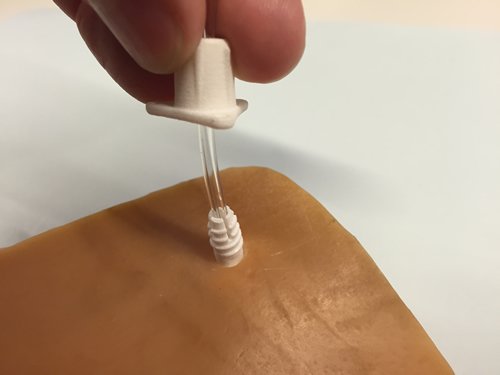 Wedo3Dprint's tweet photo. Patentan un dispositivo para drenajes cerebrales hecho con impresión 3d

#wedo3d #3d #salud
https://t.co/eYOfbHJ7zM https://t.co/fc7cTNIIyD