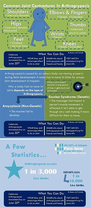 shrinershosp's tweet photo. It's #Arthrogryposis Awareness Day. Learn more about this condition &amp; care @shrinershosp  https://t.co/avJ8IQv5Hu https://t.co/log5qPhRyN