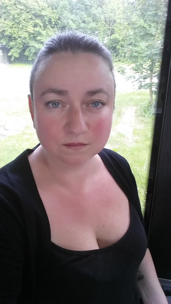 Kmoztar's tweet photo. Sådan ser et fibromyalgi-flare ud. Smerten kan ikke skjules og ej heller feberen #fibroFAIL #TheStuggleIsReal https://t.co/QgbZ78sHpz
