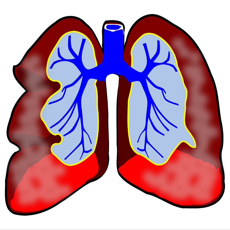 Lifeflooxygen's tweet photo. Wow,  the total length of the airways running through the two lungs is 1,500 miles. #fact #healthtalk #breahte https://t.co/y63t495qsO