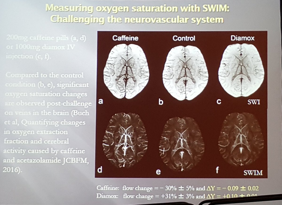 griz1's tweet photo. #Caffeine-induces changes in oxygen saturation w SWIM #DrMarkHaacke #NNS2016 @Neurotrauma @Starbucks @TheCoffeeBean https://t.co/9znXjbLUAY