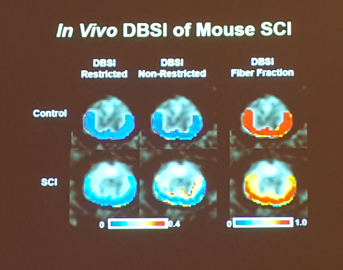 griz1's tweet photo. #DrSKSong shows #DBSI distinguishes axonal changes from #DTI #NNS2016 @Neurotrauma https://t.co/asltBiHcZH