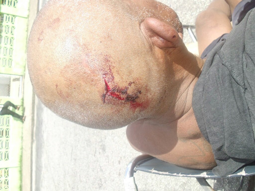 curiososnerd's tweet photo. #30Jun #Tucupita la gente protesta y la GNB arremete brutalmente contra el pueblo. @Kenabalza  https://t.co/56ozP8KKHj