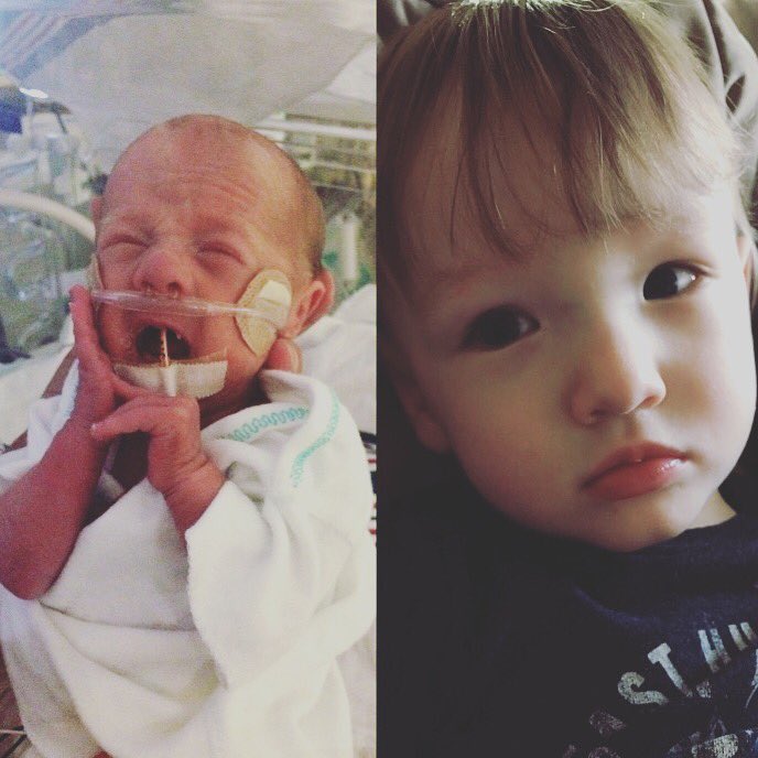 MarianneButt's tweet photo. #teammamaRoo #sweetcy #twoLBSthreeOZ #27weekers #survivingtriplets #projectsweetpeas https://t.co/Zg6ulSMFw2