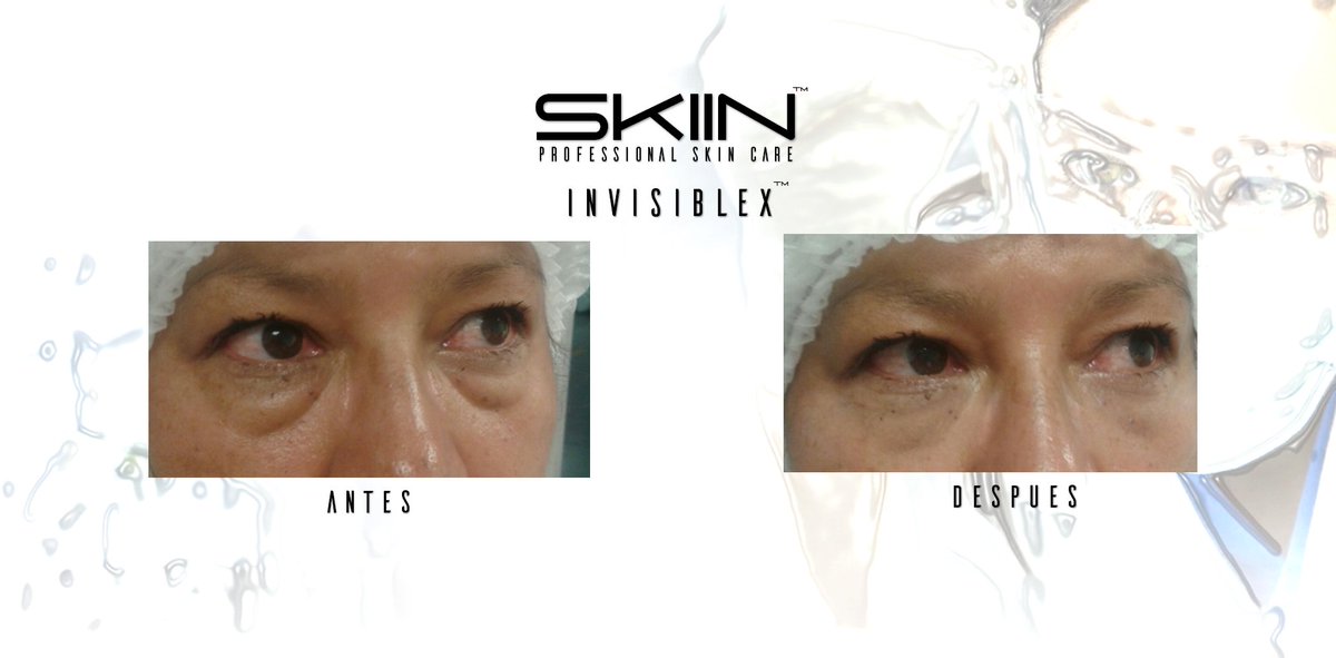 skiinmexico's tweet photo. #derma #dermatologos #medicosesteticos #cirujanosplasticos #piel #skin #cosmetica #PIELSANA #SPA https://t.co/952iTu7J3k