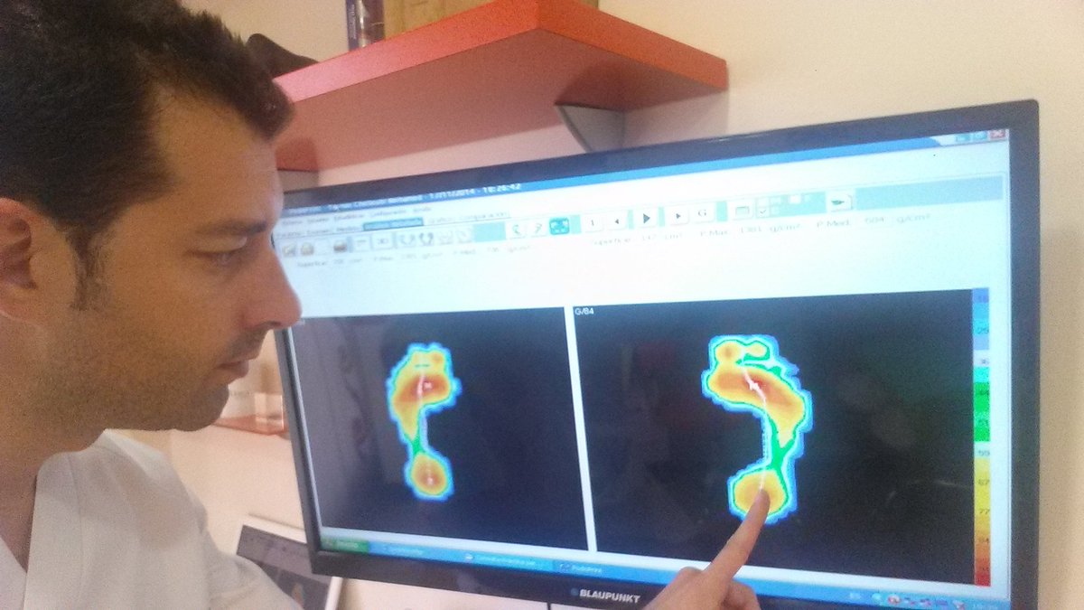 Podoleg's tweet photo. La importancia del estudio biomecánico de la marcha https://t.co/TmUCFbKIeu #podólogo #Ondara #biomecánica #runners https://t.co/xdpmQrfMs3