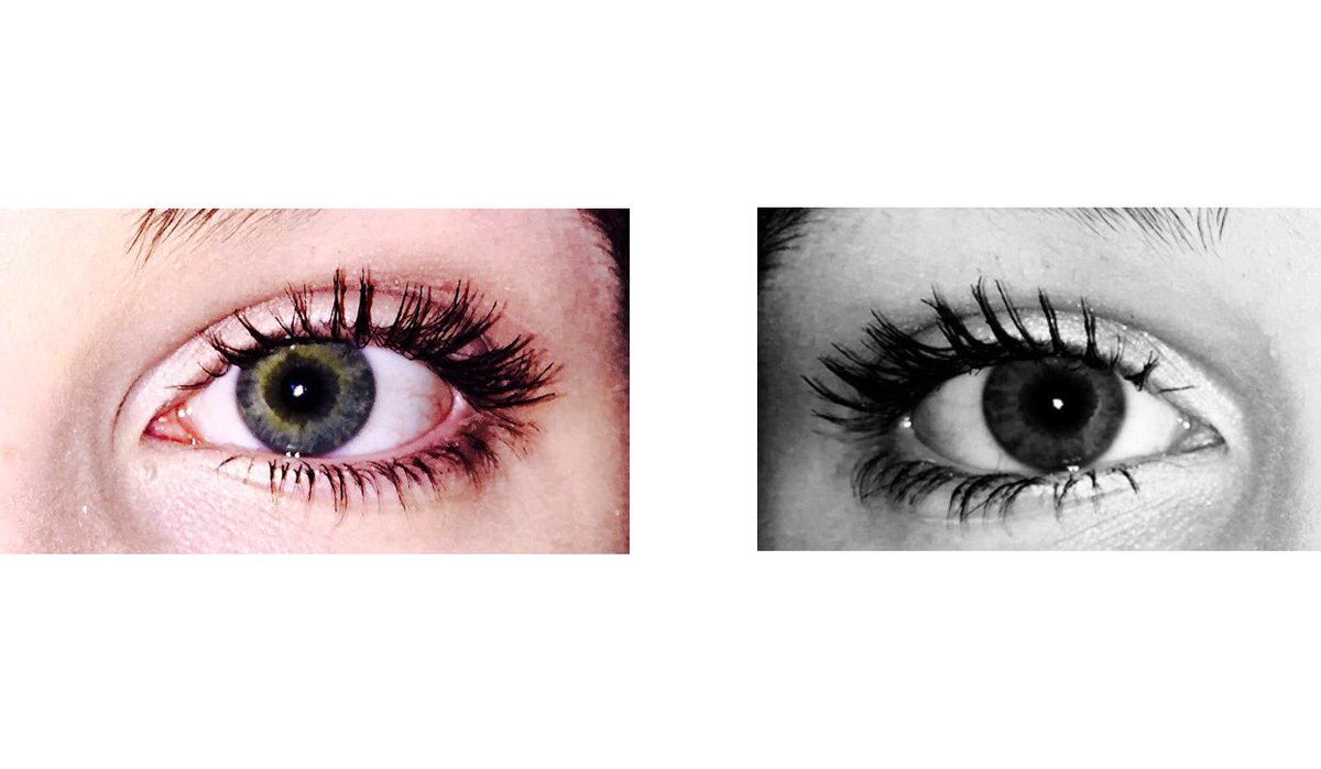 JessRubyWalker's tweet image. #swimforsight @SwimForSight inspired by @jackgilinsky and @JackJ I challenge you $25 can give someone gift of sight!