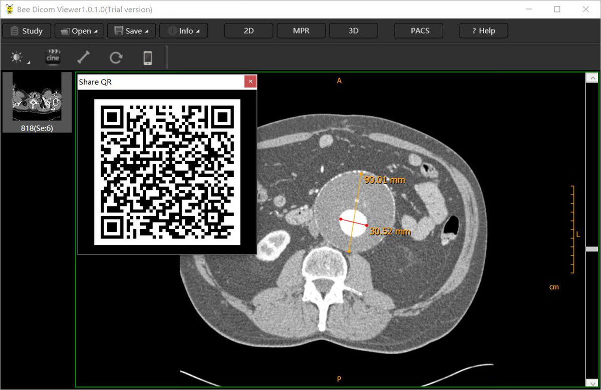 New feature, Mobile scan QR to get screen image.