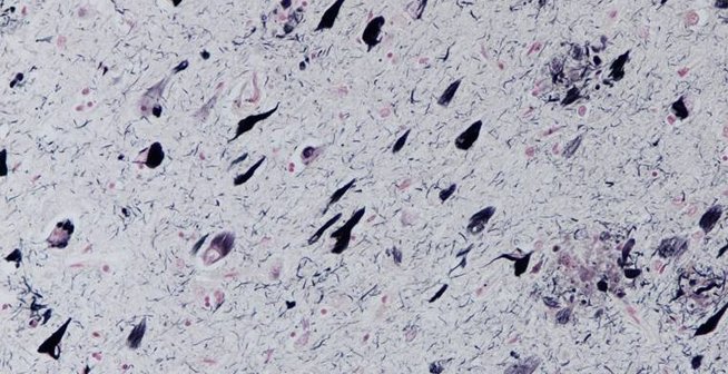 Fund_CIEN's tweet photo. #BTCIEN gestiona la recogida, procesamiento y almacenamiento de tejido cerebral para realizar estudios post-mortem. https://t.co/wRYf6fvXif