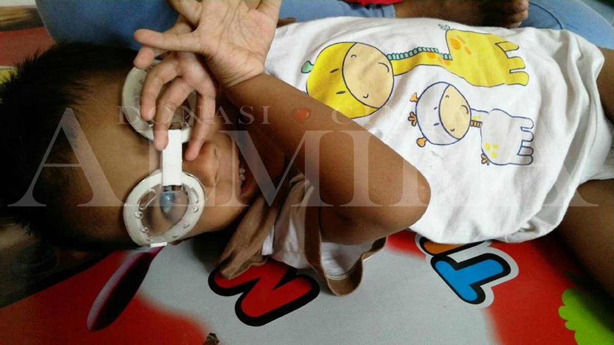 Eza pernah diangkat kasusnya oleh CDBA di bulan JUNI Eza ini Penderita retinoblastoma, syndrome rubella dan hernia