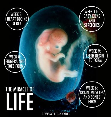 LiveAction's tweet image. To be pro-life is to be on the side of what science and reason tell us about human life in the womb.