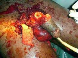 blank (@thekingpinbitch) on Twitter photo 